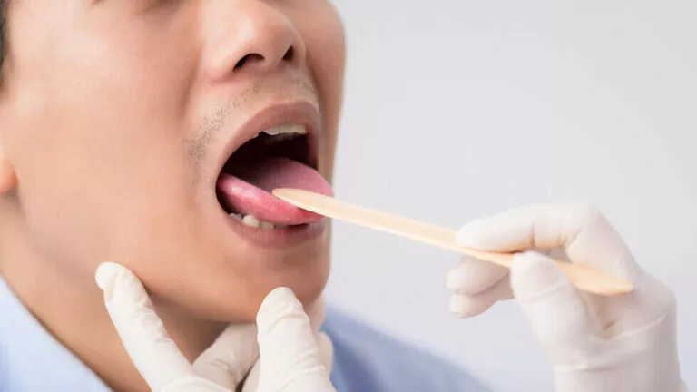 Goût de craie dans la bouche: causes, symptômes et solutions